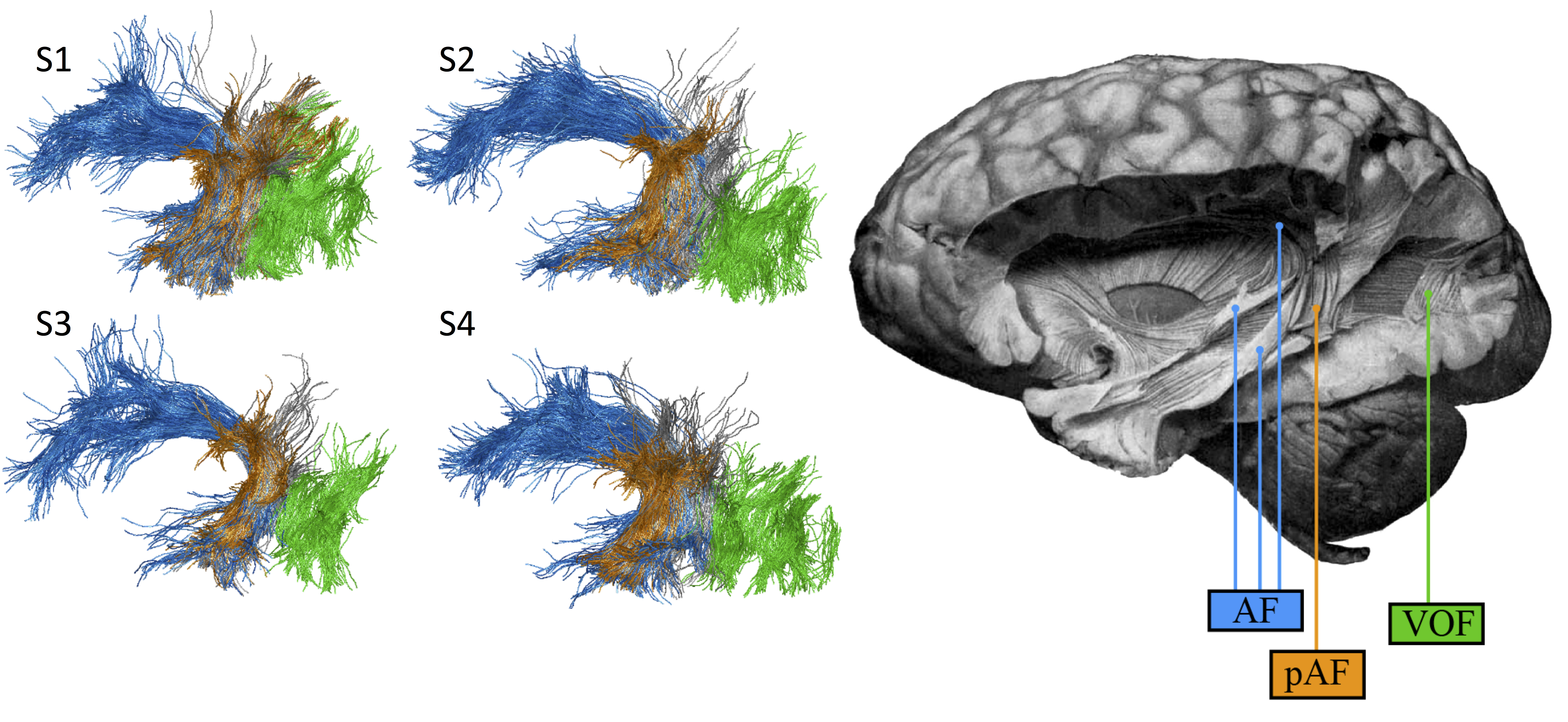 The Anatomical Connectivity Of Human Cortical Systems Cognitive